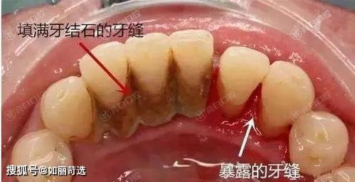 北京2024口腔医院六大排行上线,一键查询北京洗牙哪里靠谱实力好