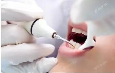 2024北京六大公办和私立口腔医院排名，种草北京洗牙靠谱评价好的牙科