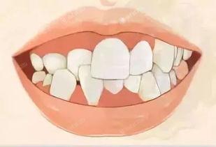 2024年秦皇岛牙齿矫正医院排名前七曝光，告诉你哪家牙齿矫正靠谱口碑好