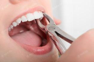2024年保定哪里牙齿矫正效果好又不贵?这份保定口腔医院排名前七强烈推荐