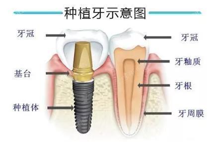 武汉靠谱口碑好的牙科医院排名，是种植牙正规口碑好的牙科诊所