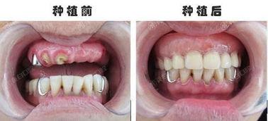 晋城种植牙好的牙科医院排名公布，都是靠谱口碑好的口腔医院