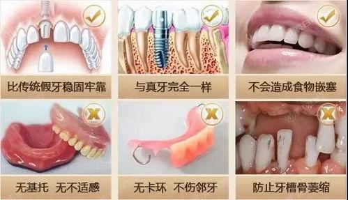西安技术好的十大口腔医院排名，种植牙技术好技术靠谱的是这十家