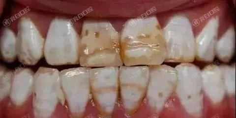 天津排名前十的全瓷牙医院名单已公布，均是正规靠谱的牙科