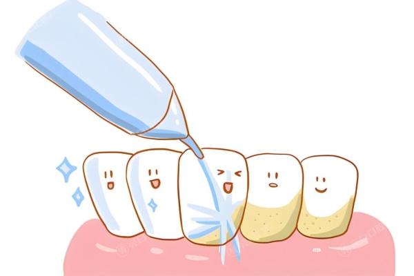 洗牙 (2).jpg