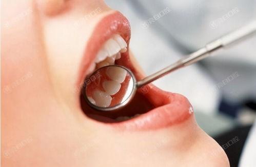 全新北京约康口腔口腔项目收费标准公开 含全瓷牙|隐形矫正|贴面|牙齿美白价格