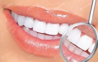 刷新贵阳口腔医院牙齿美白收费贵吗 价格表显示激光美白牙齿2000/冷光美白2000元起