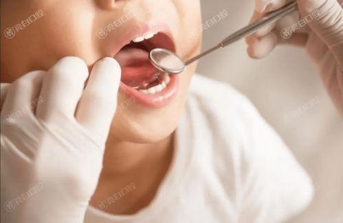 2024上海口腔医院假牙义齿收费贵吗 价格表显示拜耳牙20/纯钛支架2000元起