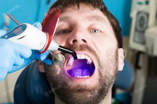 新版广州口腔医院补牙收费标准 在口腔医院做进口玻璃离子充填300