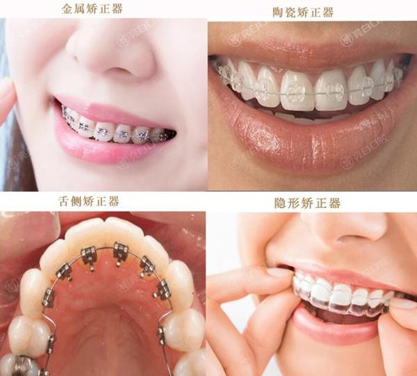 西宁口腔医院收费标准2023种植牙/补牙/拔智齿/正畸收费不贵 西宁口腔医院收费标准2023种植牙/补牙/拔智齿/正畸收费不贵