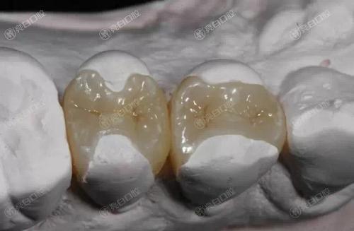 广州补牙齿到哪个医院好？这四大口腔医院靠谱实力好