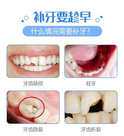 揭秘2025年成都补牙齿医院排行，众评这四家补牙齿靠谱价格好