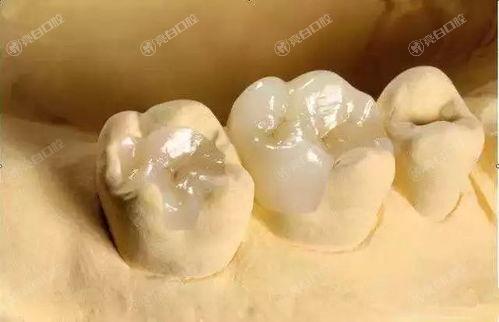 揭秘2025年广州补牙齿医院排行，众评这四家补牙齿靠谱技术好