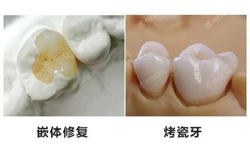 杭州口腔医院排名前三已出!做补牙齿这几家环境好不贵
