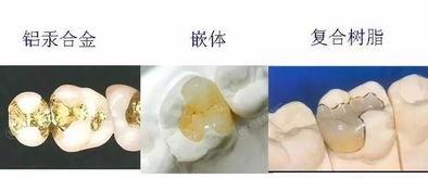 杭州2024口腔医院三大排行上线,一键查询杭州补牙齿哪里靠谱环境好