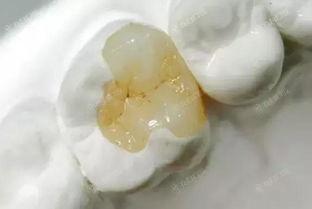 广州靠谱环境好的牙科医院排名，是补牙齿正规环境好的牙科诊所