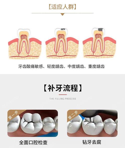 深圳补牙齿哪家医院技术好？曝2025年深圳补牙齿排行前八的口腔医院