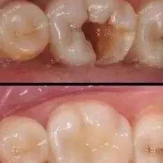 上海补牙齿哪里靠谱口碑好？速览这四家正规口碑靠谱的口腔医院