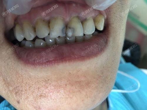 成都补牙齿哪家医院好？靠谱口碑好的四大牙科医院投递