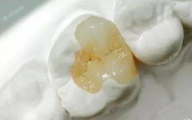 深圳口腔医院排名前八已出!做补牙齿这几家环境好不贵