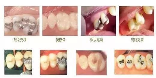揭秘2025年广州补牙齿医院排行，众评这四家补牙齿靠谱技术好