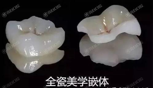 揭秘2025年深圳补牙齿医院排行，众评这八家补牙齿靠谱技术好
