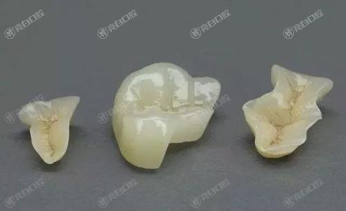 2025深圳八大公办和私立口腔医院排名，种草深圳补牙齿靠谱服务好的牙科