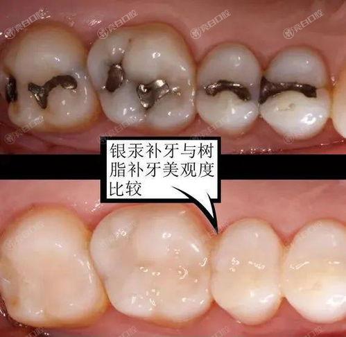 深圳口腔医院排名前八已出!做补牙齿这几家环境好不贵