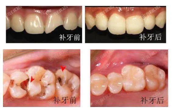 深圳补牙齿哪里靠谱评价好？速览这八家正规评价靠谱的口腔医院