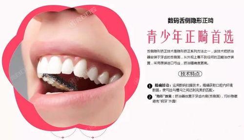 2025年郑州哪里儿童牙科效果好又不贵?这份郑州口腔医院排名前十强烈推荐