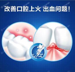 大连智齿哪家医院评价好？2025年大连智齿评分前三的口腔医院公布