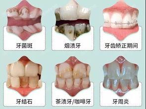 北京洗牙哪家医院好?安利排名前六的正规环境好的口腔医院