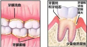 北京洗牙哪家医院好？曝靠谱实力好的洗牙前六口腔医院