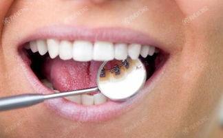 2025年北京洗牙医院排名前六曝光，告诉你哪家洗牙靠谱技术好