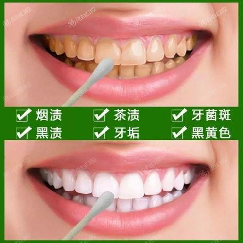 北京2025口腔医院六大排行上线,一键查询北京洗牙哪里靠谱口碑好