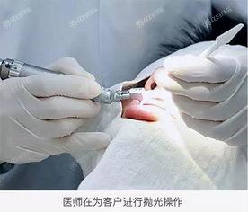 揭秘2025年北京洗牙医院排行，众评这六家洗牙靠谱技术好