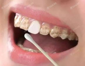 深圳2025口腔医院三大排行上线,一键查询深圳洗牙哪里靠谱服务好