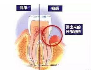 2024北京洗牙口碑好的医院公布，排名前六的洗牙实力好