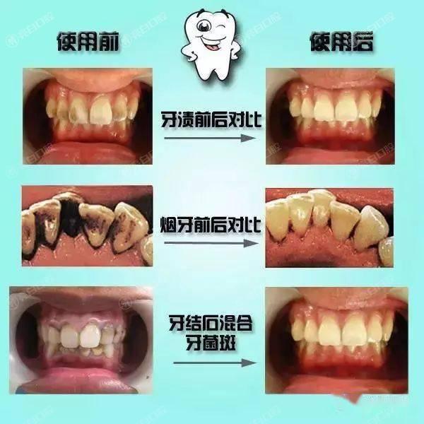 2025年北京洗牙医院排名榜更新，排名前六的牙科花落谁家？