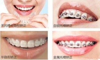 2023年深圳牙齿矫正实力排名榜单：正规且价格好的牙科都在此