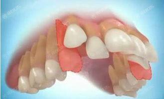 北京十大牙科医院排名榜，评选2024年北京牙齿矫正技术水平高的牙科诊所