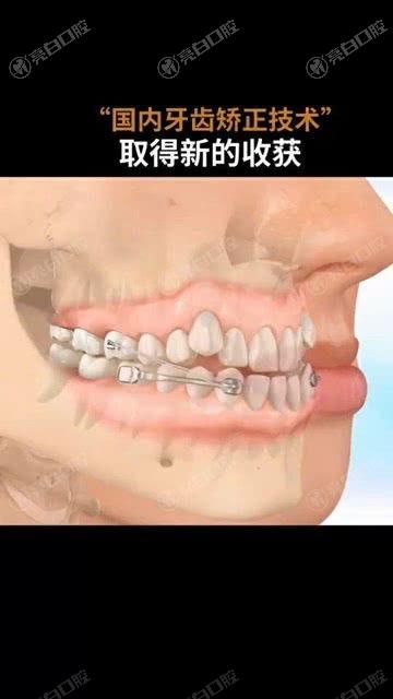 惠州牙齿矫正哪个医院好？速来参考2025八大牙科排行榜