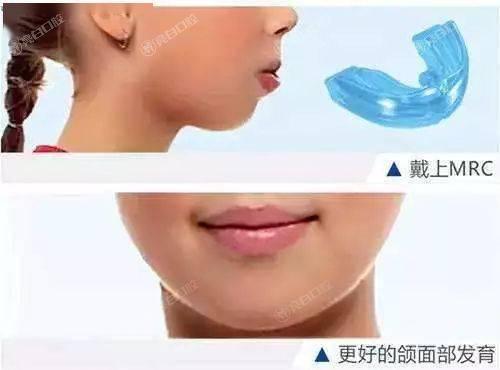 2024龙岩牙齿矫正排名前三的口腔医院公开啦！亦是正规环境靠谱的口腔医院