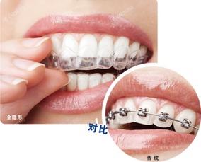 济南牙科医院2025九大排名安利,牙齿矫正服务超赞的牙科请get