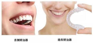 汉中牙齿矫正哪个医院好？评分高环境靠谱的牙齿矫正排名榜找到了