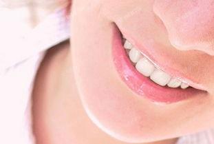 试问无锡牙齿美白价格是多少，无锡牙齿美白价格太圈粉了吧！