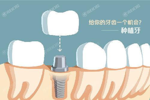 2023年天津种植牙医院排名前十曝光，告诉你哪家种植牙靠谱价格好