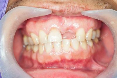 西安评价好的十大口腔医院排名，种植牙技术好评价靠谱的是这十家