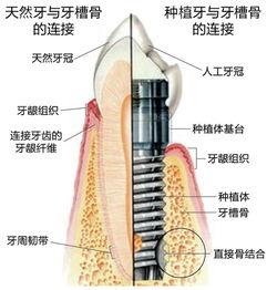 汕头种植牙哪里靠谱价格好？速览这六家正规价格靠谱的口腔医院