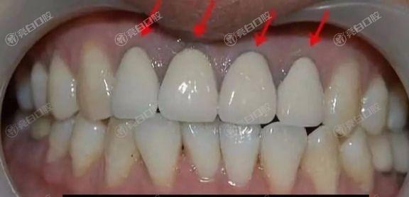 北京烤瓷牙到哪个医院好？这十大口腔医院靠谱环境好